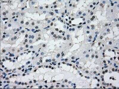 Immunohistochemistry-Paraffin: L1CAM Antibody (OTI2A6) [NBP2-02149]