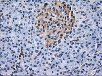 Immunohistochemistry-Paraffin: L1CAM Antibody (OTI2A6) [NBP2-02149]