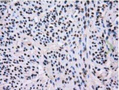 Immunohistochemistry-Paraffin: L1CAM Antibody (OTI2A6) [NBP2-02149]