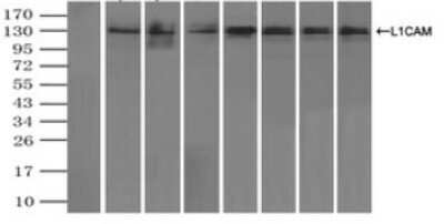 Immunoprecipitation: L1CAM Antibody (OTI2A6) [NBP2-02149]