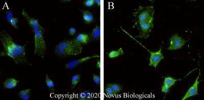 Immunocytochemistry/ Immunofluorescence: L1CAM Antibody (UJ127.11) - BSA Free [NB100-2682]