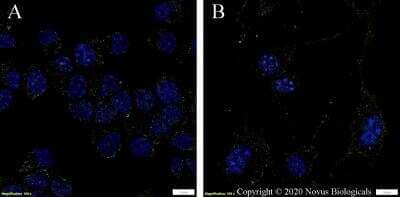 Immunocytochemistry/ Immunofluorescence: L1CAM Antibody (UJ127.11) - BSA Free [NB100-2682]
