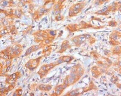 Immunohistochemistry-Frozen: L1CAM Antibody (UJ127.11) - BSA Free [NB100-2682]