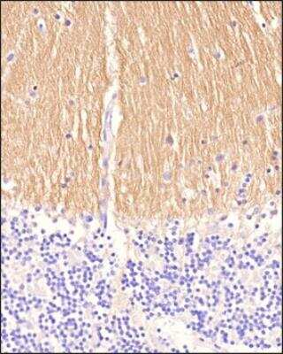 Immunohistochemistry-Paraffin: L1CAM Antibody (UJ127.11) - BSA Free [NB100-2682]