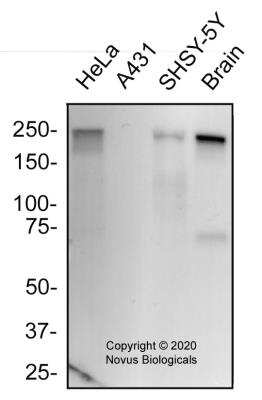 Western Blot: L1CAM Antibody (UJ127.11)BSA Free [NB100-2682]