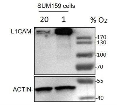 Western Blot: L1CAM Antibody (UJ127.11)BSA Free [NB100-2682]