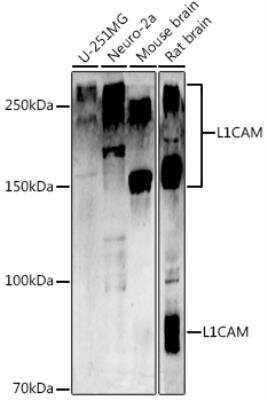 Western Blot: L1CAM AntibodyBSA Free [NBP3-03276]