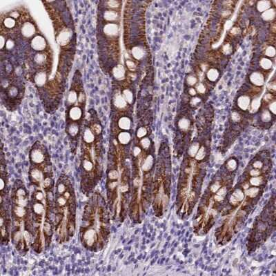 Immunohistochemistry-Paraffin: L2HGDH Antibody [NBP2-49445]