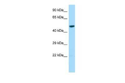 Western Blot: L2HGDH Antibody [NBP2-85197]