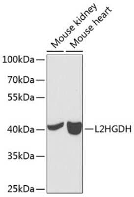 Western Blot: L2HGDH AntibodyBSA Free [NBP3-04541]