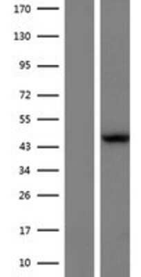 Western Blot: L2HGDH Overexpression Lysate [NBP2-06265]