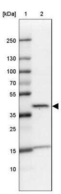 Western Blot: L3HYPDH Antibody [NBP2-31648]