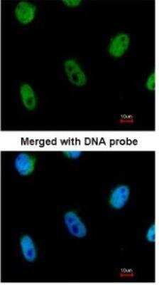 Immunocytochemistry/ Immunofluorescence: L3MBTL1 Antibody [NBP1-32447]