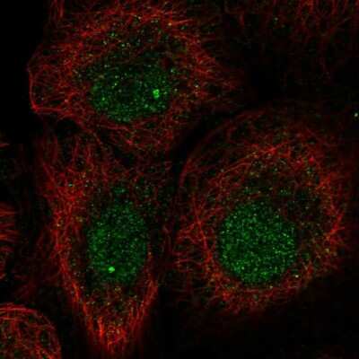 Immunocytochemistry/ Immunofluorescence: L3MBTL1 Antibody [NBP2-68865]