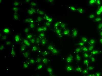 Immunocytochemistry/ Immunofluorescence: L3MBTL1 Antibody - BSA Free [NBP3-05093]