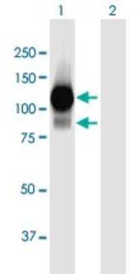 Western Blot: L3MBTL1 Antibody [H00026013-B01P]