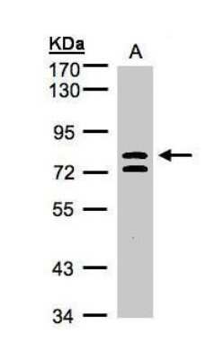 Western Blot: L3MBTL1 Antibody [NBP1-32447]