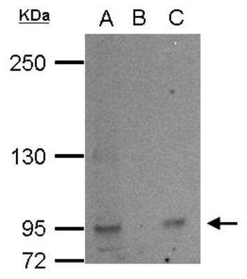 Western Blot: L3MBTL2 Antibody [NBP1-32621]