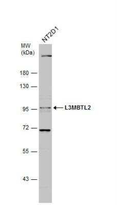 Western Blot: L3MBTL2 Antibody [NBP1-32621]