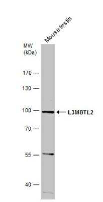 Western Blot: L3MBTL2 Antibody [NBP1-32621]