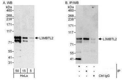 Western Blot: L3MBTL2 Antibody [NBP1-49964]