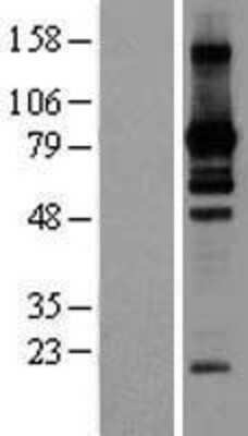 Western Blot: L3MBTL2 Overexpression Lysate [NBP2-06118]