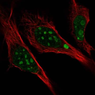 Immunocytochemistry/ Immunofluorescence: L3MBTL3 Antibody [NBP2-14181]