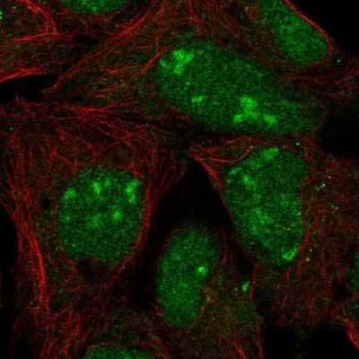 Immunocytochemistry/ Immunofluorescence: L3MBTL3 Antibody [NBP2-58442]