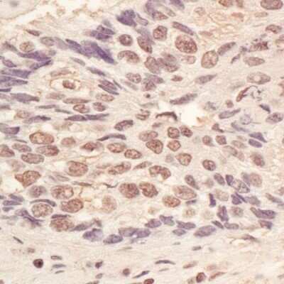 Immunohistochemistry: L3MBTL3 Antibody [NBP1-47316]