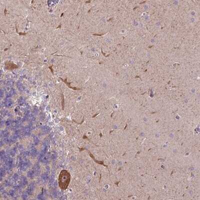 Immunohistochemistry-Paraffin: L3MBTL3 Antibody [NBP2-14181]
