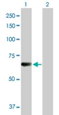 Western Blot: L3MBTL4 Antibody [H00091133-D01P]