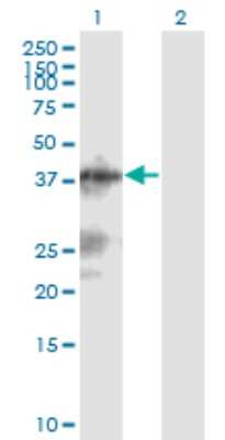 Western Blot: LACC1 Antibody (2A1) [H00144811-M04]