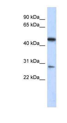 Western Blot: LACC1 Antibody [NBP1-56736]