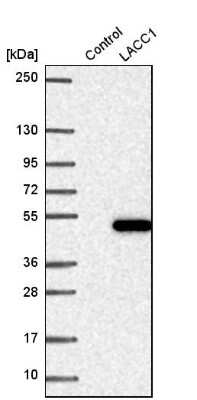 Western Blot: LACC1 Antibody [NBP1-92062]