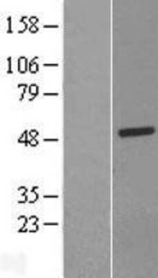 Western Blot: LACC1 Overexpression Lysate [NBL1-08163]