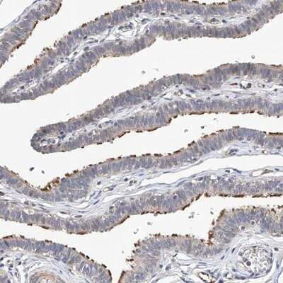 Immunohistochemistry-Paraffin: LACE1 Antibody [NBP1-89215]