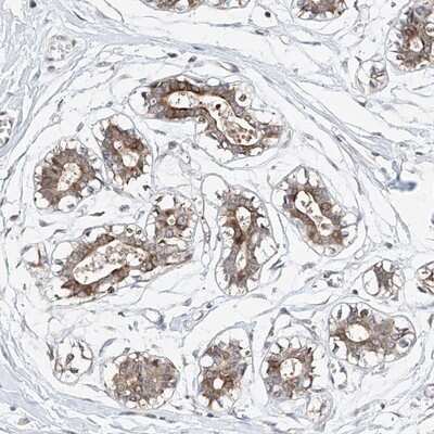 Immunohistochemistry-Paraffin: LACE1 Antibody [NBP1-89216]