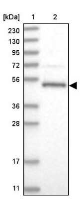 Western Blot: LACE1 Antibody [NBP1-89215]