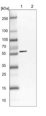 Western Blot: LACE1 Antibody [NBP1-89215]