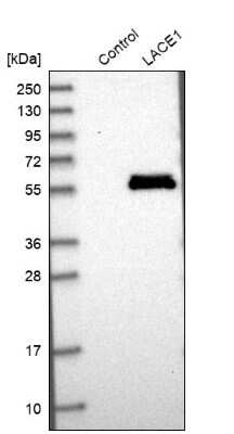 Western Blot: LACE1 Antibody [NBP1-89216]