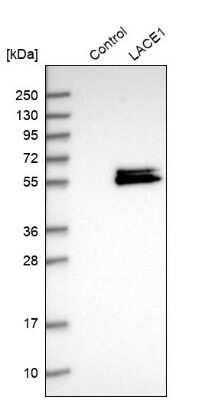 Western Blot: LACE1 Antibody [NBP1-89217]