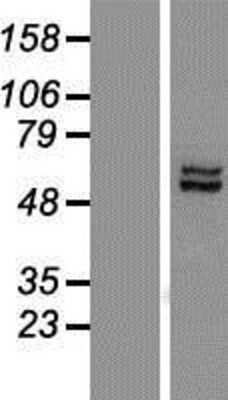 Western Blot: LACE1 Overexpression Lysate [NBP2-05487]