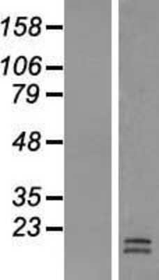 Western Blot: LACRT Overexpression Lysate [NBL1-12421]