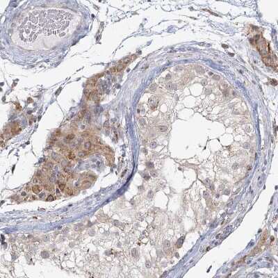 Immunohistochemistry-Paraffin: LACTB Antibody [NBP1-91701]