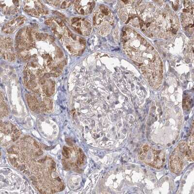 Immunohistochemistry-Paraffin: LACTB Antibody [NBP1-91701]