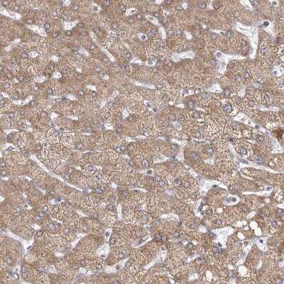 Immunohistochemistry-Paraffin: LACTB Antibody [NBP1-91701]