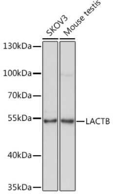 Western Blot: LACTB AntibodyAzide and BSA Free [NBP3-16652]