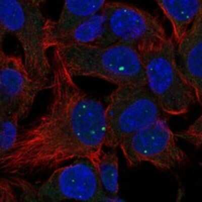 Immunocytochemistry/ Immunofluorescence: LACTBL1 Antibody [NBP3-17599]