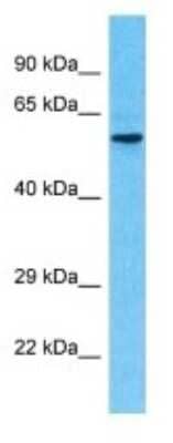 Western Blot: LACTBL1 Antibody [NBP3-09744]