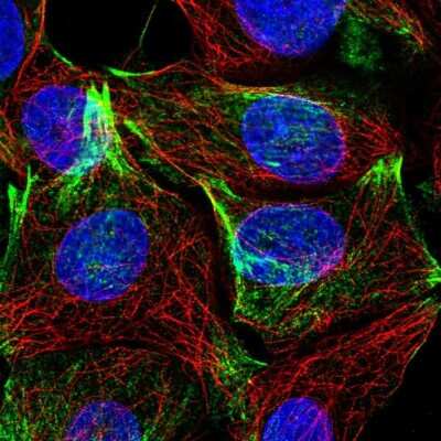 Immunocytochemistry/ Immunofluorescence: LAD1 Antibody [NBP1-86126]